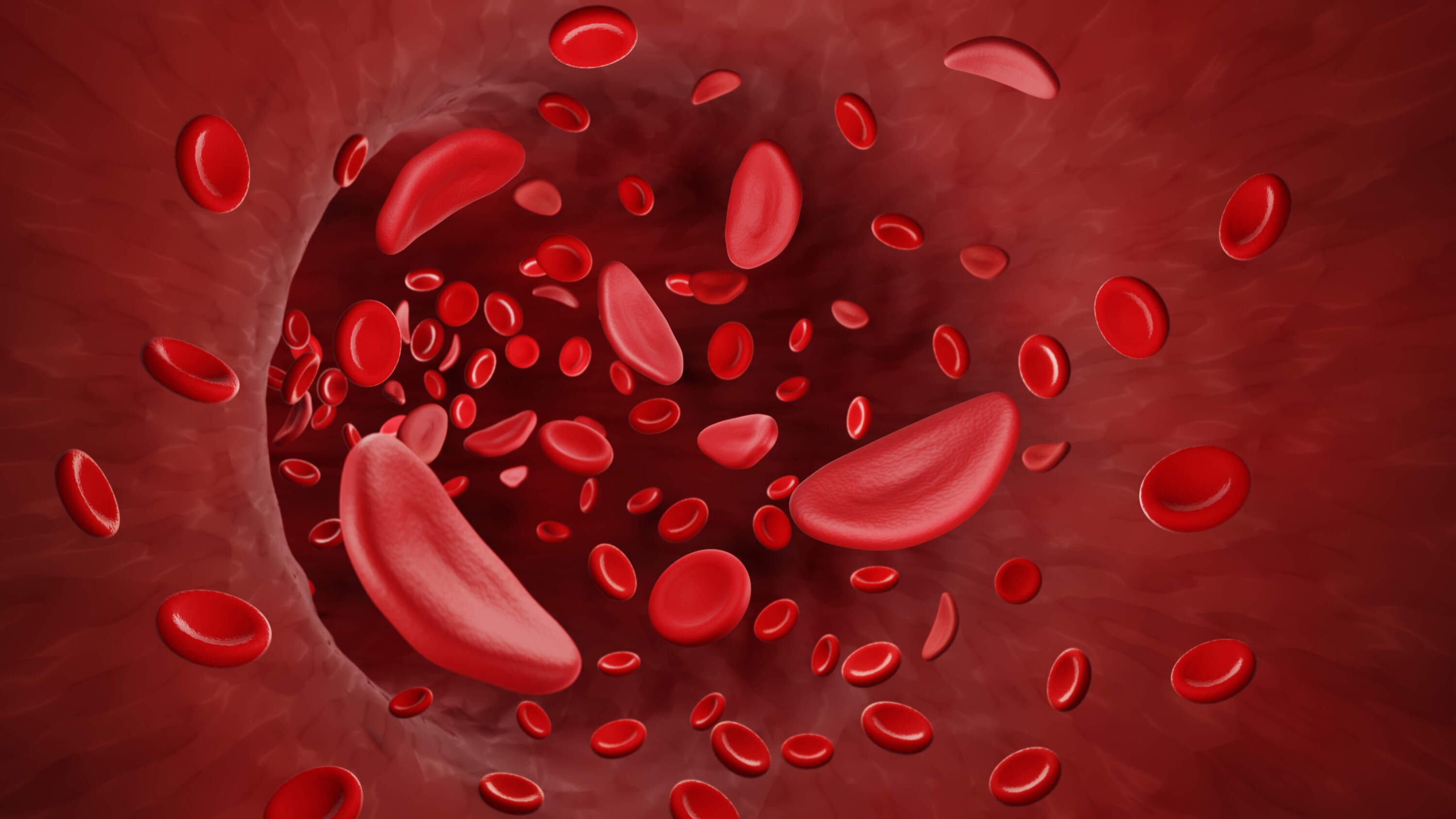 Illustration of sickle cells in blood flow. (Artur Plawgo/Science Photo Library/Getty Images)