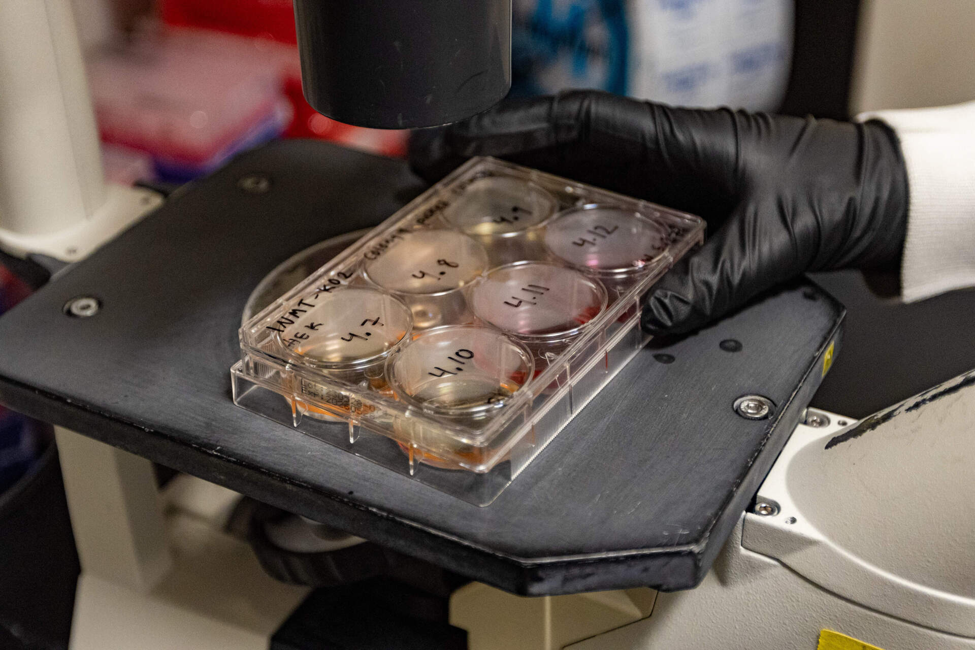 Researcher Karis Will examines a set of patient-derived stem cells through a microscope at Massachusetts General Hospital. (Jesse Costa/WBUR)