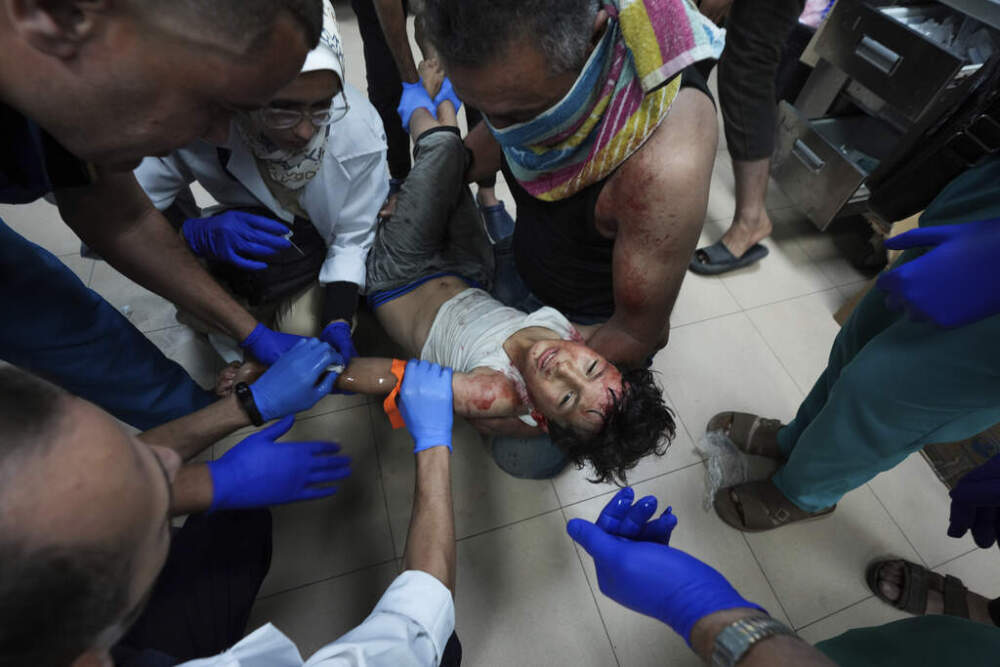 A Palestinian child wounded in the Israeli bombardment of the Gaza Strip is treated in a hospital in Deir al-Balah, Monday, Sept. 23, 2024. (Abdel Kareem Hana/AP)