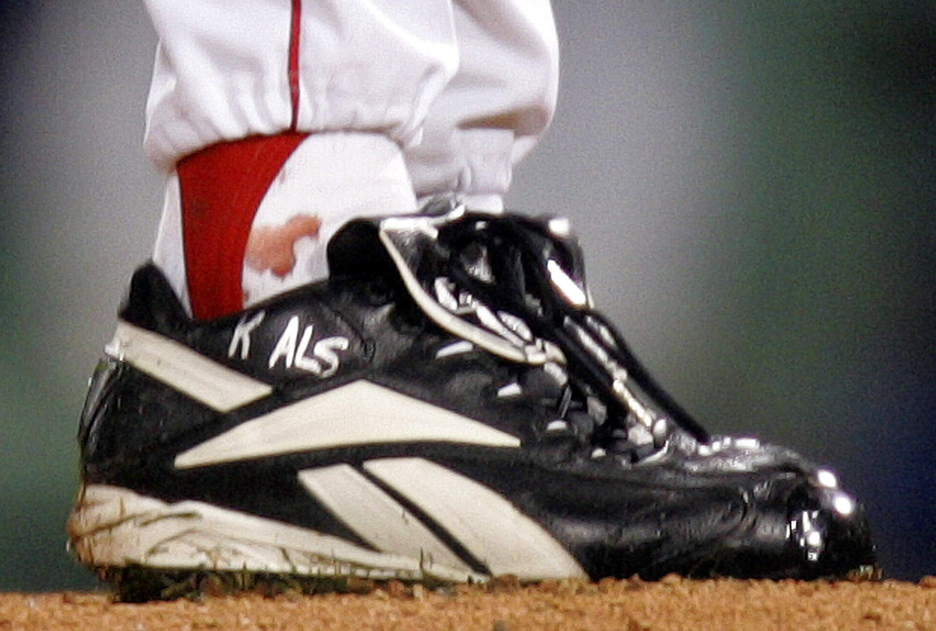 Blood seeps through the sock of Boston Red Sox pitcher Curt Schilling during the first inning of Game 2 of the World Series in Boston. Schilling played through a tendon tear in his ankle. (Winslow Townson/AP)