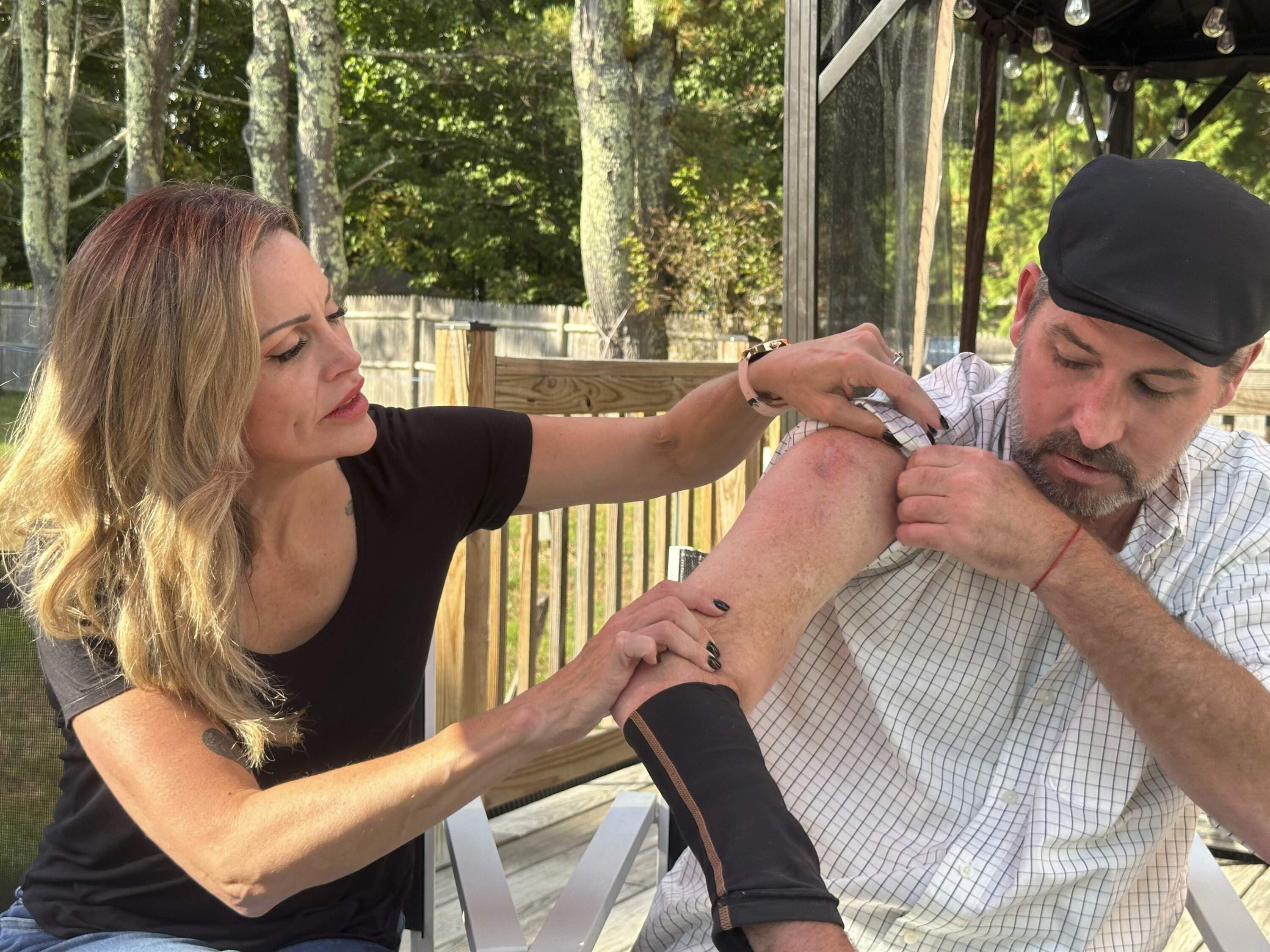 Lewiston mass shooting survivor Ben Dyer (right) and fiancée Keela Smith examine Dyer's injuries from the 2023 massacre and talk about their plans for the future on Wednesday, Oct. 3, 2024 in Auburn, Maine. (AP Photo/Nick Perry)