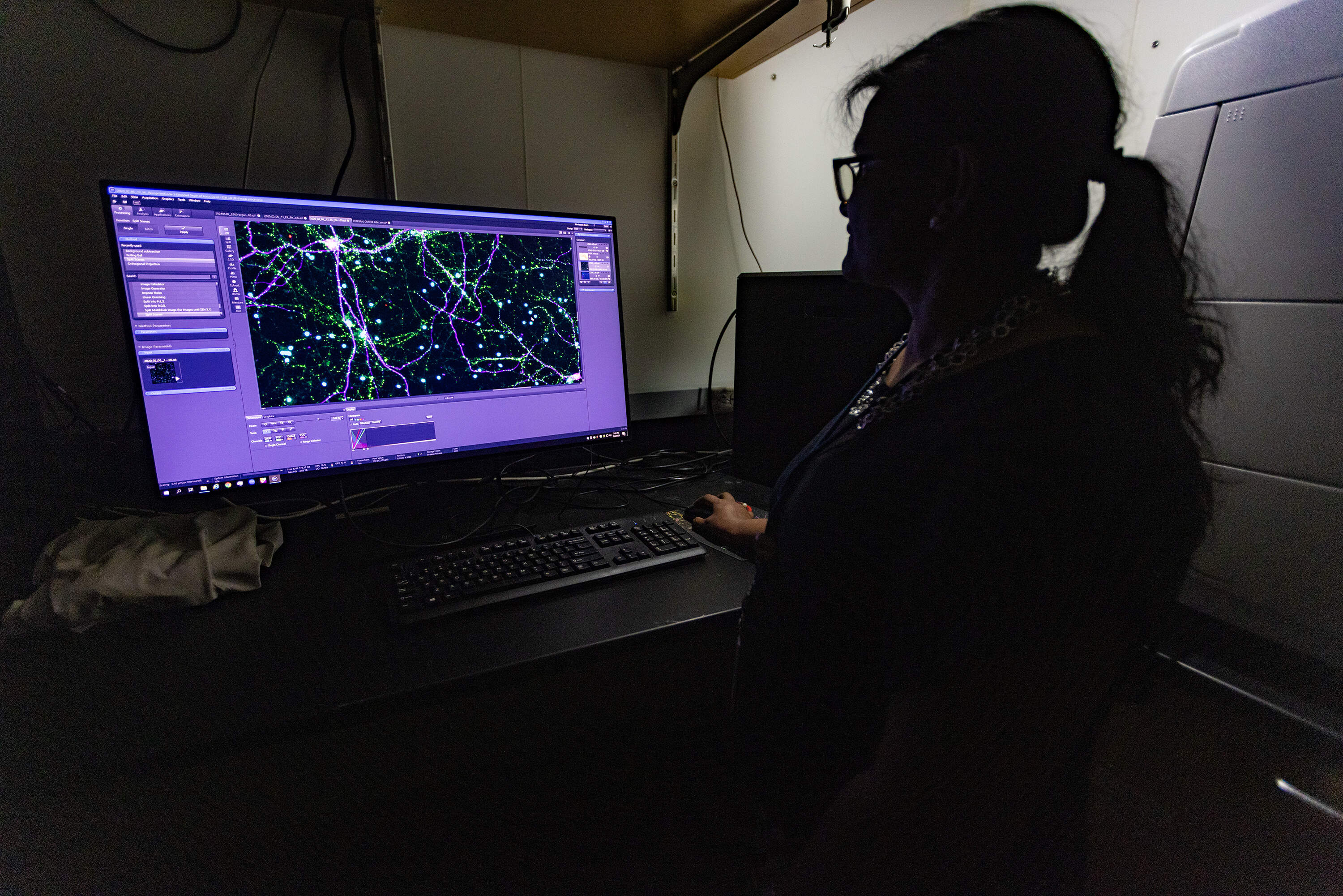 Surya Reis executive Director of the medicinal plant laboratory at Massachusetts General Hospital, looks at brain cells that were created from stem cells derived from patient skin cells. She’s trying to see how those brain cells react to potentially psychoactive compounds.