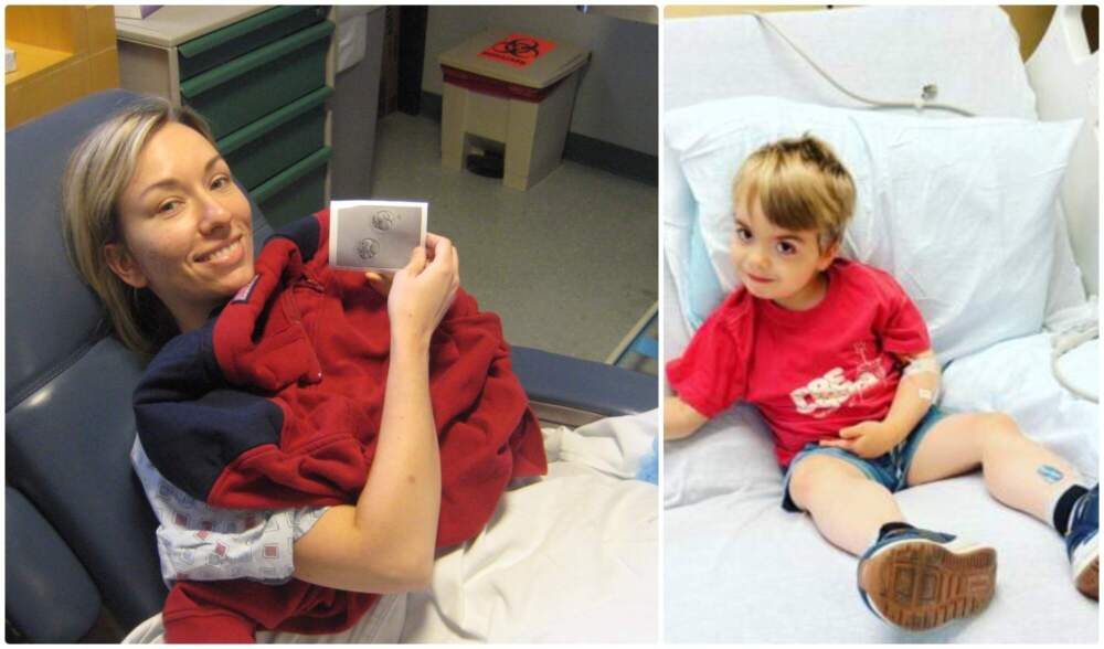 (Left) The author on transfer day during her first cycle of IVF. (Right) The author's son, Charlie, receiving his first infusion as part of a clinical trial of a gene therapy for Duchenne muscular dystrophy in 2022. (Courtesy Jennifer Handt)