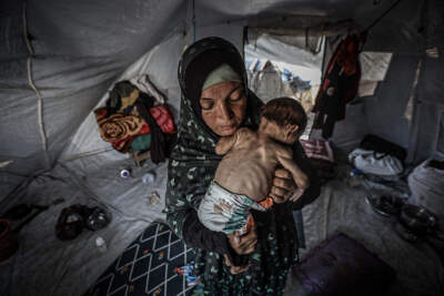 The 'deluge of misery' in Gaza is acute. And we Jews, especially, must not look away