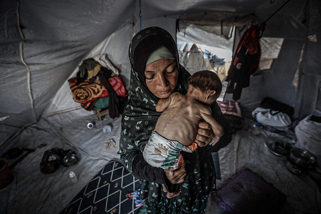 The 'deluge of misery' in Gaza is acute. And we Jews, especially, must not look away