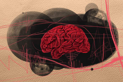 Brainwaves: Are you in there?