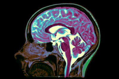 Brainwaves: Why is the brain such a mystery?