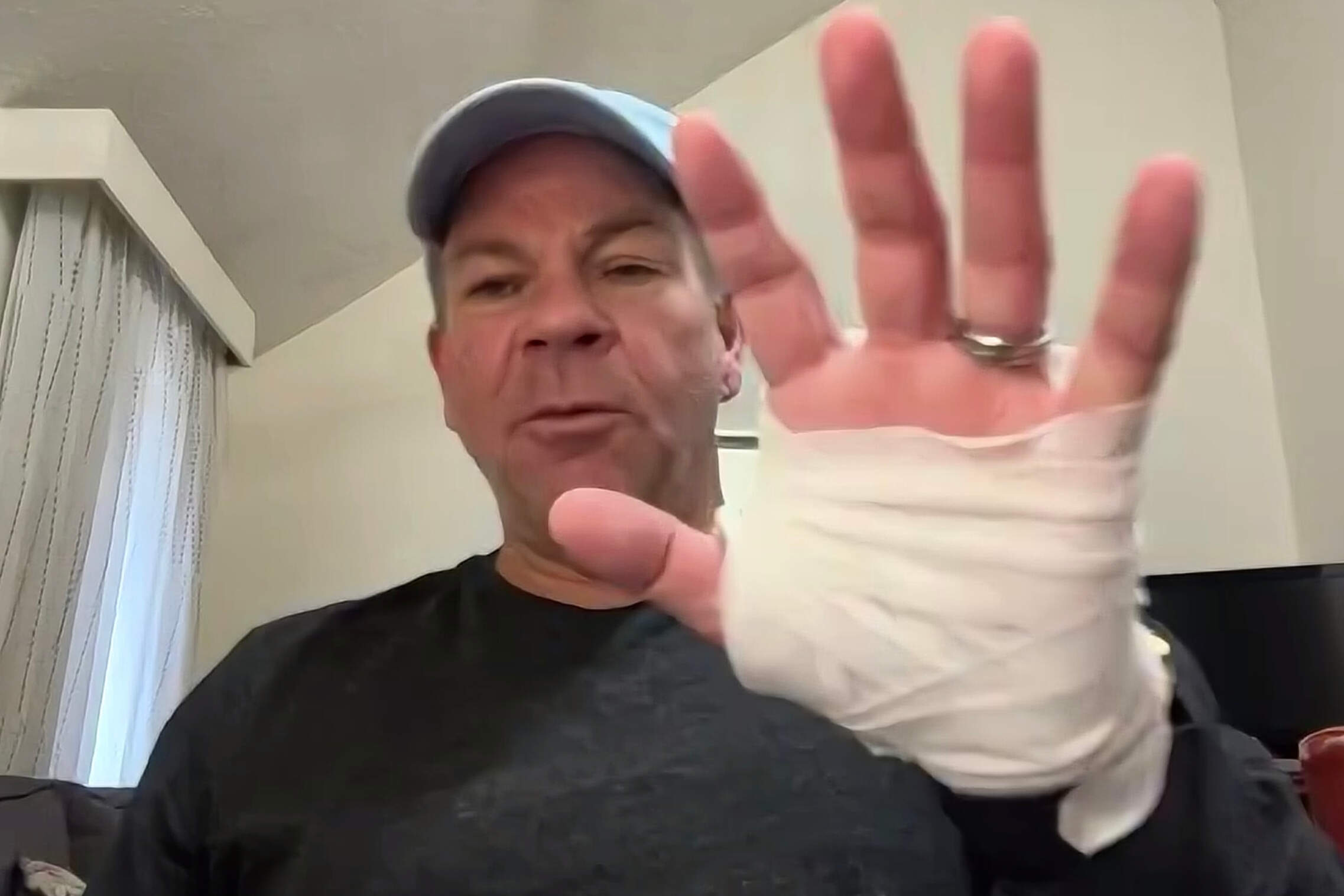 In this image taken from video, Michael Black, a Rhode Island man who helped stop a shooter at a high school hockey game on Monday, holds up his injured hand during an interview with The Associated Press. (AP Photo)