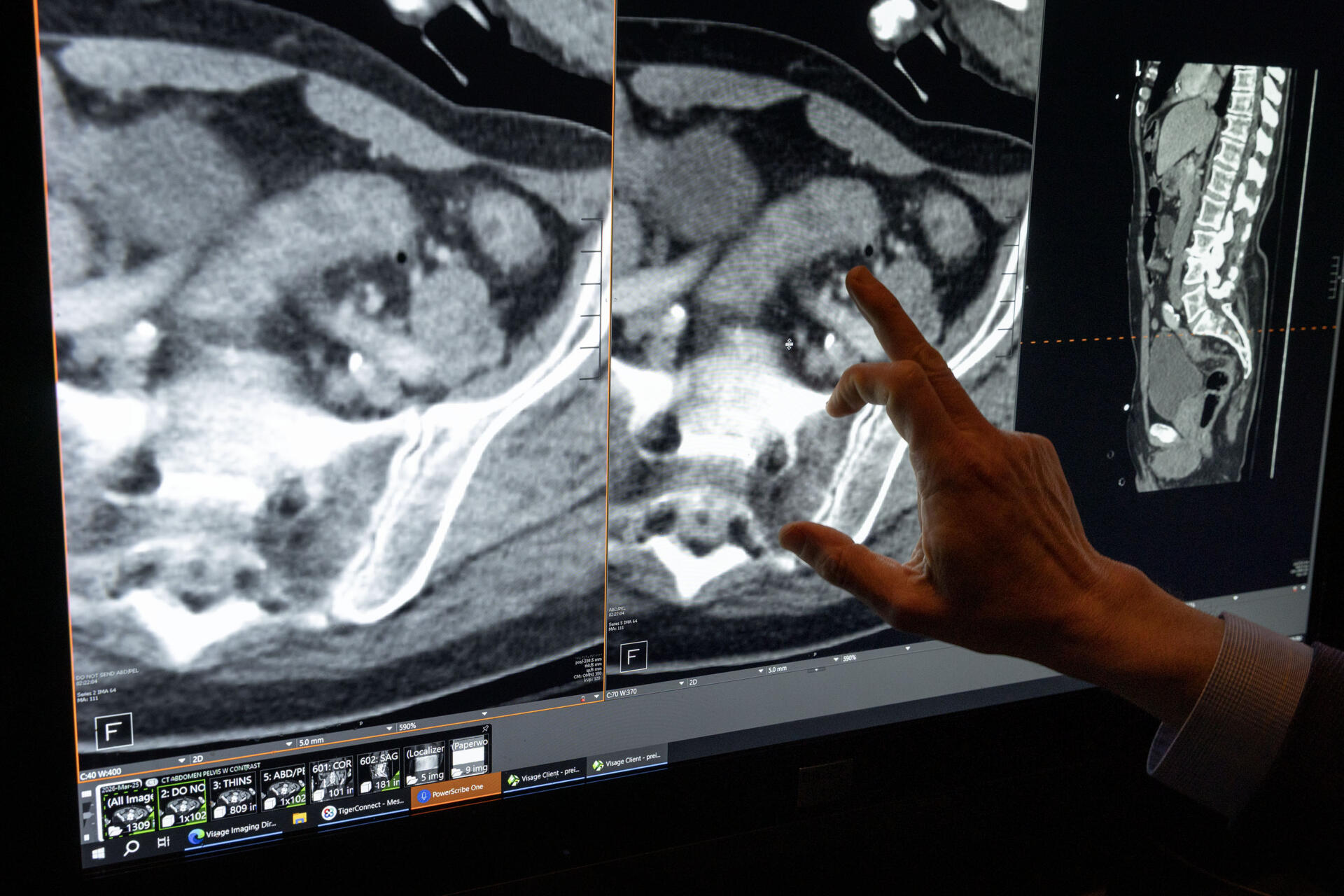 Dr. Ori Preis, a radiology specialist at South Shore Health in Weymouth, Mass. shows how AI tools can improve the clarity of diagnostic imaging. (Robin Lubbock/WBUR)