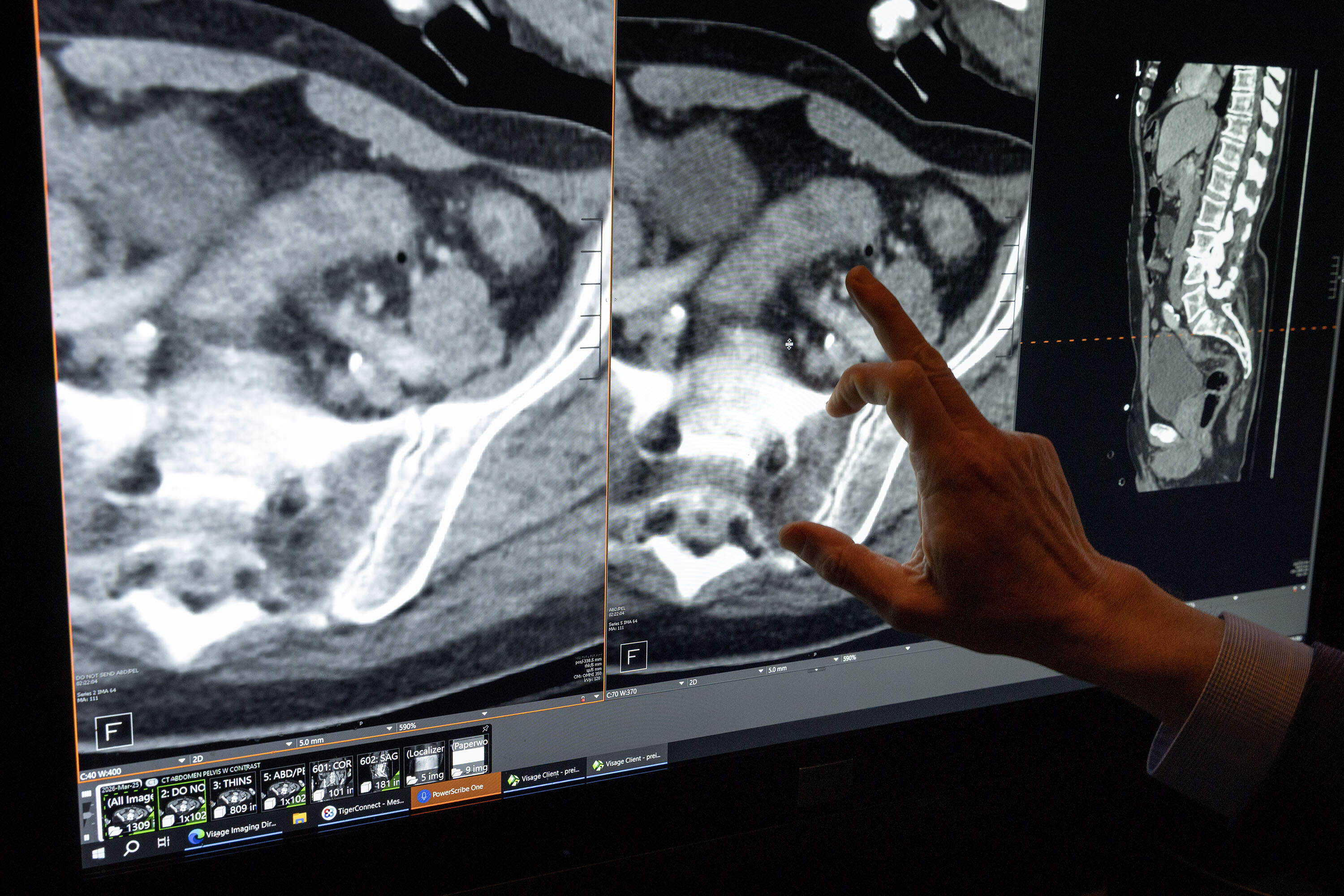 Dr. Ori Preis, a radiology specialist at South Shore Health in Weymouth, Mass. shows how AI tools can improve the clarity of diagnostic imaging. (Robin Lubbock/WBUR)