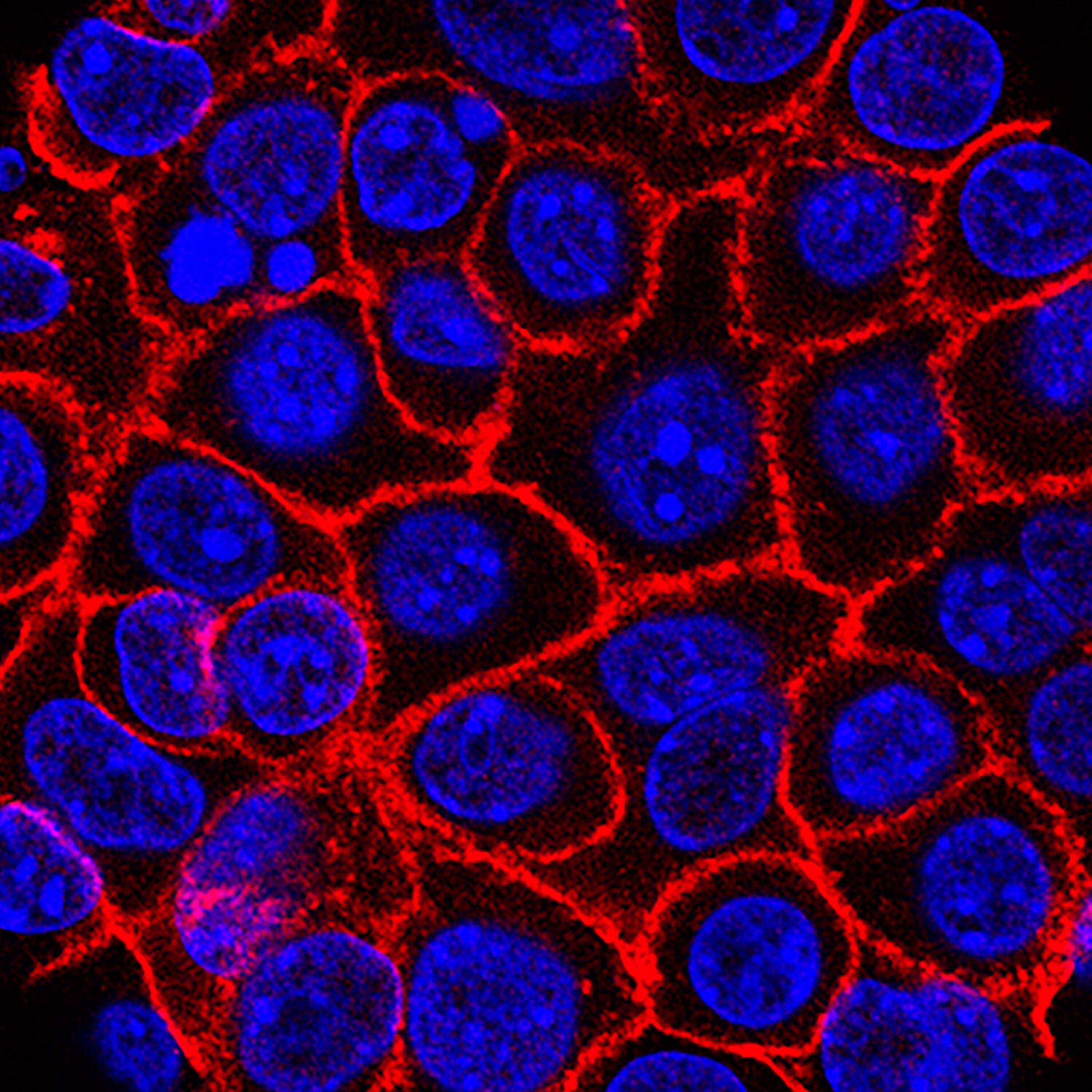  The pill bringing new hope to patients with pancreatic cancer 